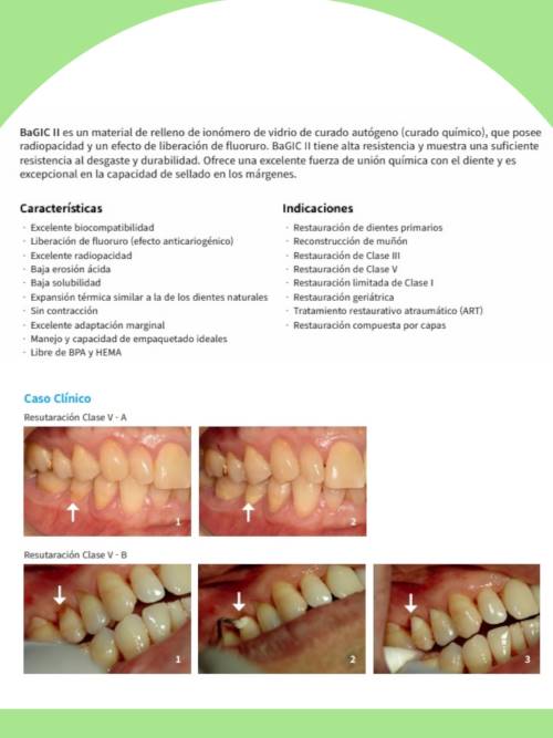 Vidrio Ionómero de reconstrucción BaGic II A2